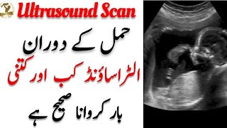 How Many Times Ultrasound Is Safe During Pregnancy l Ultrasound Scan During Pregnancy l Mother Diary [upl. by Battiste]