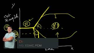 EDAIC essentials Thromboelastography [upl. by Bell]