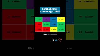 ECG Leads for Localizing STEMIs [upl. by Vassili59]