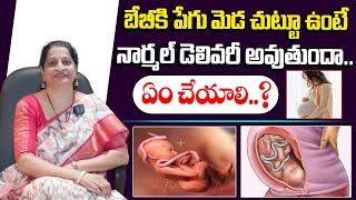 బేబీకి పేగు మెడ చుట్టూ ఉంటే డెలివరీ అవుతుందా  In Normal Delivery Possible It Cord Around The Neck [upl. by Gaul]