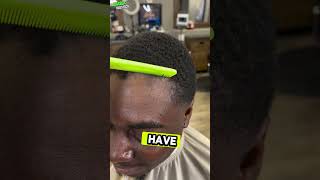 quotRestoring Hairline Before amp After Resultsquot [upl. by Arinaid]