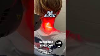 Class 4 laser therapy is easing neck pain after a car accident Start your recovery now 💪 [upl. by Tila266]