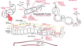 Microbiology  Helicobacter Pylori Ulcer [upl. by Salas]