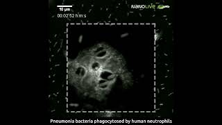 Labelfree live cell imaging of pneumonia bacteria phagocyted by neutrophils [upl. by Aninnaig]