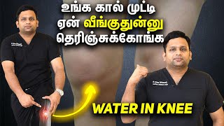 Explains Water in the Knee Dr Shriram krishnamoorthy  Tamil [upl. by Adnerb]