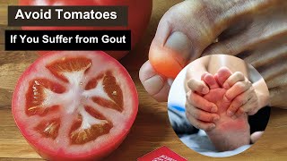 Avoid Tomatoes If You Suffer from Gout [upl. by Derfiniw]