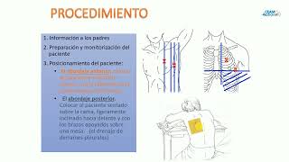 Toracocentesis y Sonda Endopleural [upl. by Keene42]