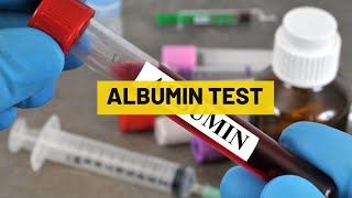 Albumin Test  My Lab Solution [upl. by Hallett]