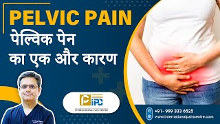 Pelvic Pain का एक और कारण  Explained by Dr Amod Manocha [upl. by Nairdna]