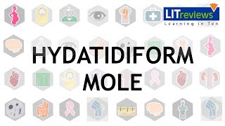 Hydatidiform Mole [upl. by Jacobo]