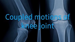 Knee joint MotionsOsteokinematics and Arthrokinematics [upl. by Sokil]