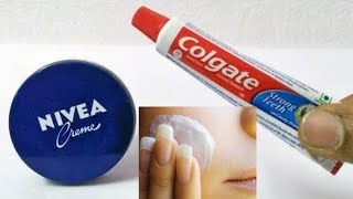 DIY Colgate Toothpaste Nivea Creme Natural Beauty Fairness Skin Care Life Hacks InstantSimple Trick [upl. by Airbas898]