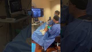 Ultrasound Guided Sclerotherapy Being Performed [upl. by Leinod]