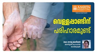 Vitiligo Awareness Day  വെള്ളപ്പാണ്ടിന് പരിഹാരമുണ്ടോ  Insights and Management Tips [upl. by Berghoff652]