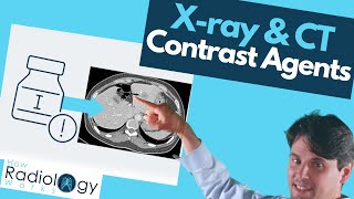 Contrast Agents in Xray and CT Scans What You Need to Know [upl. by Easter440]