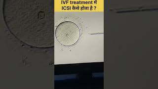 ICSI Procedure in IVF Intracytoplasmic sperm injection fertilitytreatment ivfjourney ivfsuccess [upl. by Jerri]