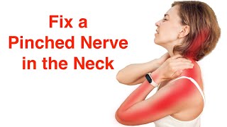 Fix a Pinched Nerve in the Neck With FREE Exercise Sheet [upl. by Enatan]