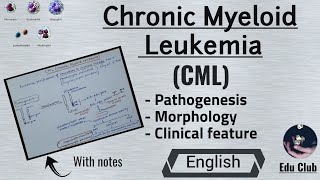 Chronic myeloid leukemia  CML  Pathology In English [upl. by Acissey]