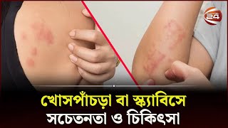 খোসপাঁচড়া বা স্ক্যাবিসে সচেতনতা ও চিকিৎসা  Scabies  Health Tips  Skin Care  Channel 24 [upl. by Tresa]