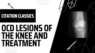 Sports Citation Classics 05 OCD Lesions of the Knees and Treatment [upl. by Arbe]