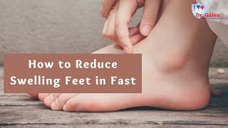 How to reduce swelling feet in fast [upl. by Naletak]