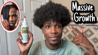 How To Apply Wild Growth Hair Oil To Afro Hair For Massive Hair Growth [upl. by Eartha]