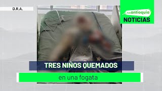 Tres niños quemados en una fogata  Teleantioquia Noticias [upl. by Nnel]