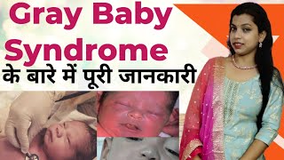 Gray Baby Syndrome  What is Gray Baby Syndrome  Nandini Study Point [upl. by Other]