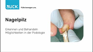 Nicht giftig aber ungenießbar – der Nagelpilz [upl. by Bartolomeo]