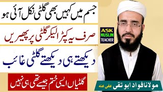 Galy ki Gilti Khatam Hone Ka Wazifa  Wazifa for Removing Cervical lymphnode Sore Throat [upl. by Dillon]