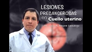 LESIONES EN CUELLO UTERINO POR QUE NO PAPANICOLAOU [upl. by Eimrej716]