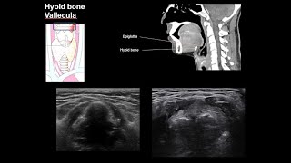 ENGNeck anatomy 1center [upl. by Sluiter]