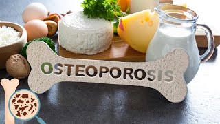 Osteoporosis  Everything You Need To Know [upl. by Eenwahs]