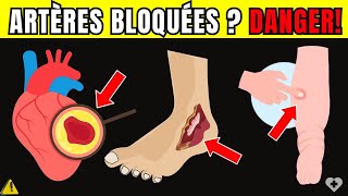 🛑Alerte Cardiaque 7 Signes dartères Bloquées Dans les Jambes et Les Pieds qui Mettent vie Danger [upl. by Nnyliram]