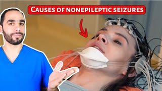 Causes of Nonepileptic Seizures PNES Hint NOT Stress [upl. by Anehc884]