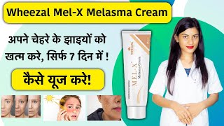 Wheezal MelX Cream Uses in Hindi  Wheezal MelX Cream Review  Mel X Cream  Mel X Melasma Cream [upl. by Katharine]