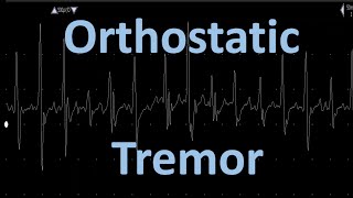 Orthostatic Tremor [upl. by Yarled]