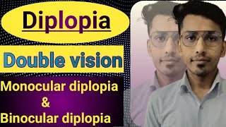 Diplopia Double vision difference between monocular amp binocular diplopia [upl. by Mace]