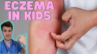 Everything you need to know about Eczema in kids Causes symptoms treatment amp home management [upl. by Novyak]