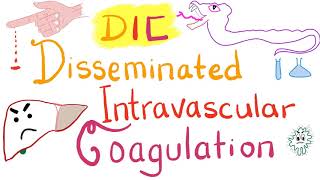 Disseminated Intravascular Coagulation DIC [upl. by Alled]