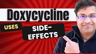 Your guide to Doxycycline uses and side effects [upl. by Alderman]