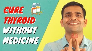 Cure Thyroid Without Medicine  How To Cure Thyroid Naturally Without Medicine [upl. by Eeliab439]