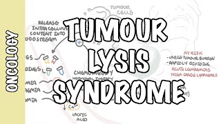 Tumour Lysis Syndrome Tumor Lysis Syndrome  pathophysiology diagnosis and treatment [upl. by Mcarthur]