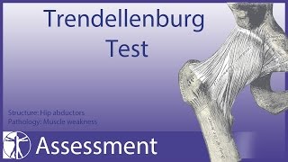 Trendelenburg Test  Hip Abductor Weakness [upl. by Stenger]