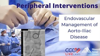 Endovascular Management of AortoIliac Disease – December 2020 [upl. by Jandy]