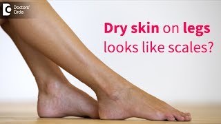 Great tips to get rid of very dry flaky skin on legs  Dr Rasya Dixit  Doctors Circle [upl. by Jat732]