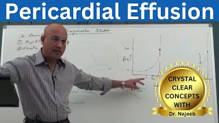 Pericardial Effusion  Pericardium  Cardiology🫀 [upl. by Arbua942]