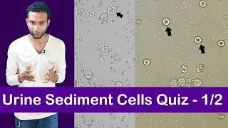 Urine Sediment Cell Identification Training Quiz  12 [upl. by Asilehs]