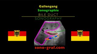 Sonographie  Gallengang [upl. by Karna]