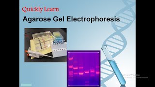 Agarose Gel Electrophoresis [upl. by Eirellav]